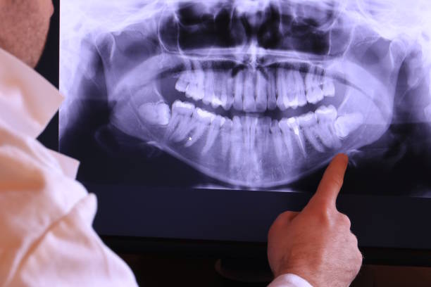 Best Emergency Dental Services for Seniors in Kountze, TX
